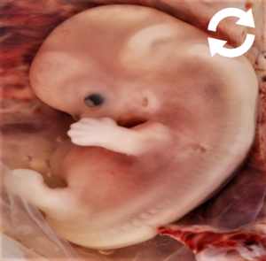 Foetus humain en développement